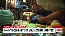 Four-month-old baby gets measles, are others infected?
