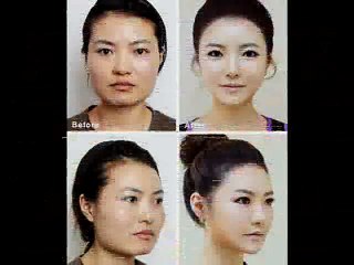 Dallas Plastic Surgery