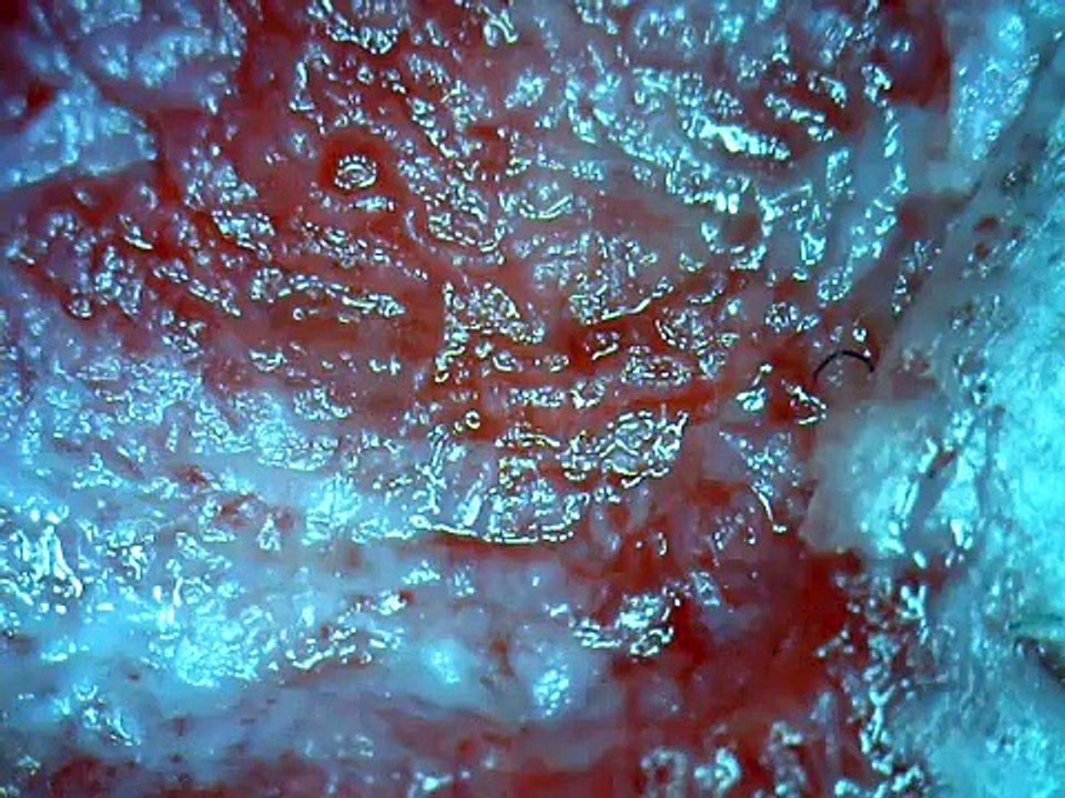 ~ MORGELLONS COLLECTION ~