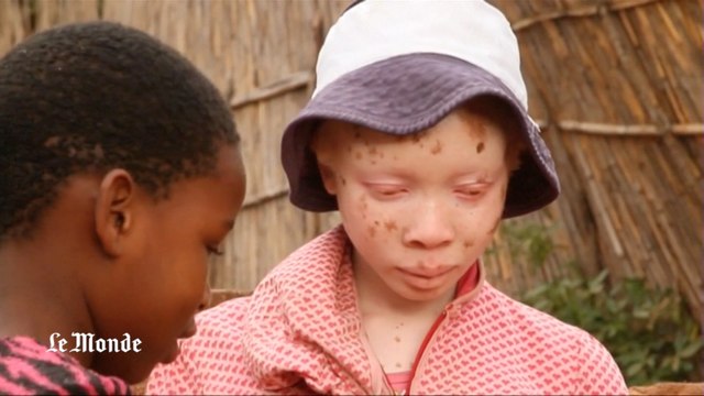 Malawi : les autorités durcissent le ton face aux tueurs d'albinos