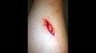 Horrific knife attack wounds caught on tape ( WARNING pictures of graphic wounds )
