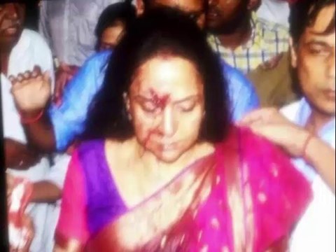 Breaking! Hema Malini severely injured in road accident
