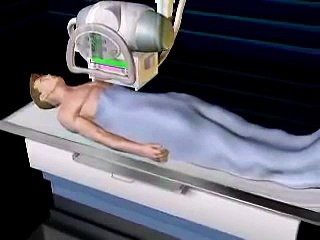 CAT  and  X - RAY Scan- الاشعه المقطعيه واشعه اكس