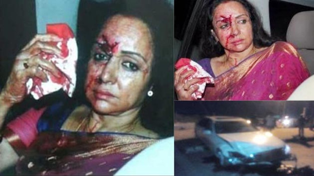 Hema Malini's Road Accident, Suffers Head Injury