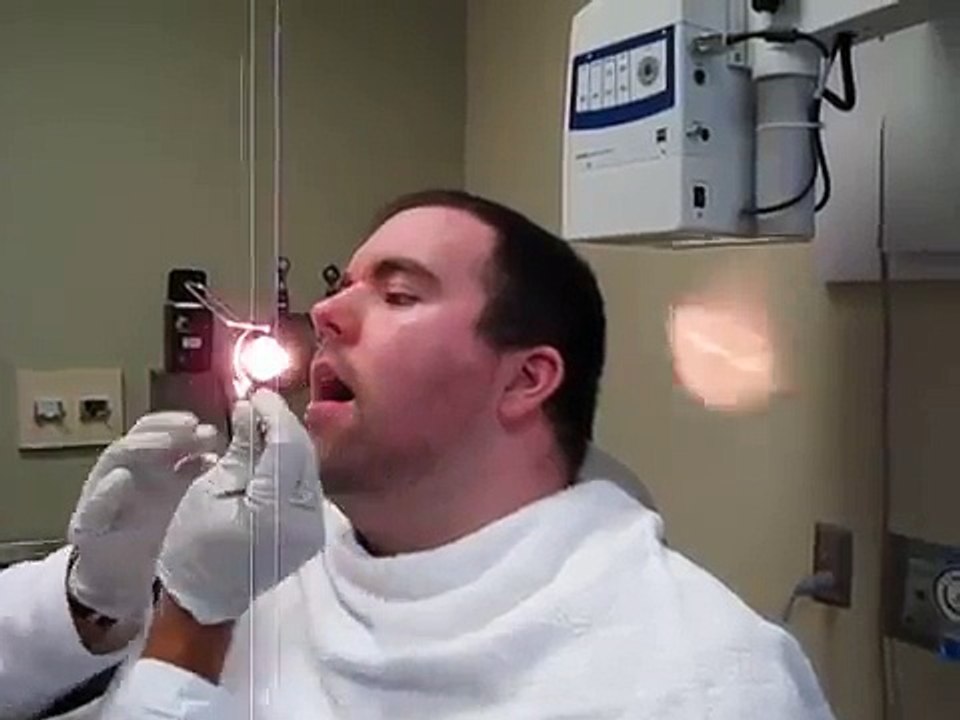 Septoplasty and Turbinate Reduction Nasal Splint Removal