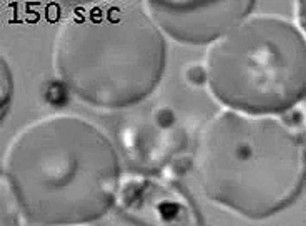 Plasmodium falciparum STEVOR facilitates parasite invasion of red blood cells