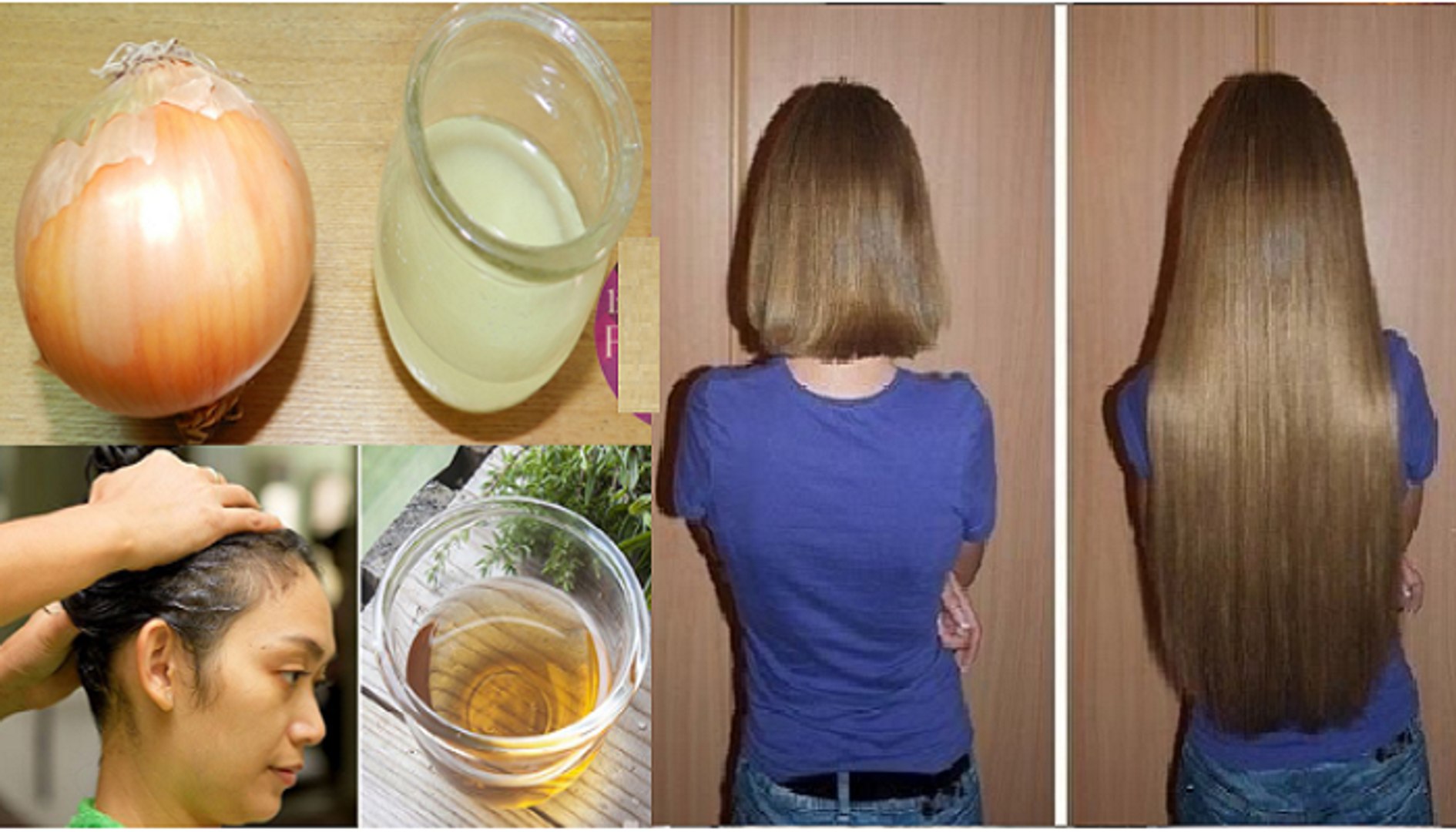 How to Grow Hair Fast using Onion Juice - video Dailymotion