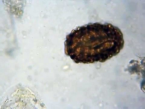 Ovo de Ascaris lumbricoides (larvado) - Estágio FMU Sto Amaro