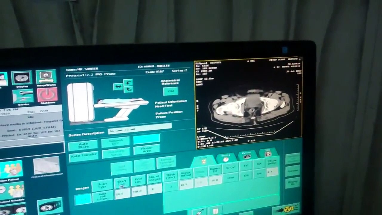 CT Scan of Nose and Sinus:How It's done? Dr.K.O.Paulose FRCS DLO