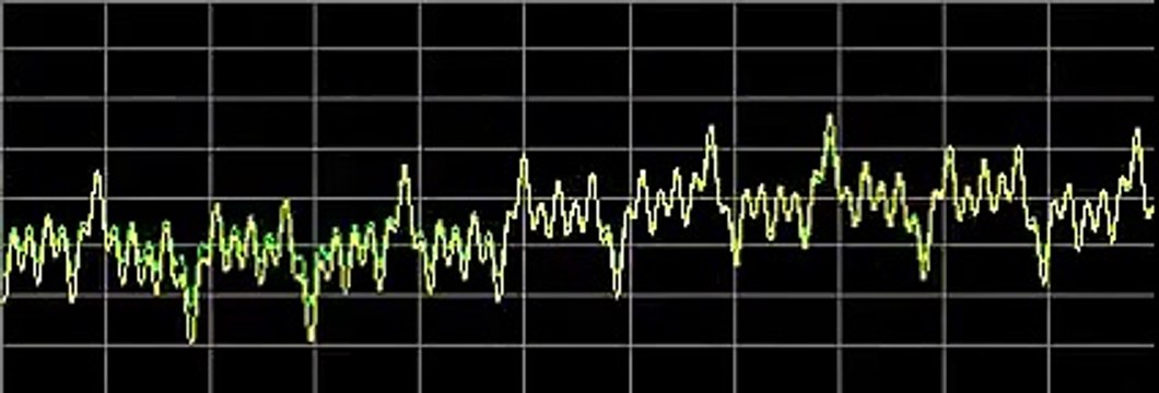 Lung Diseases - Rife Frequencies
