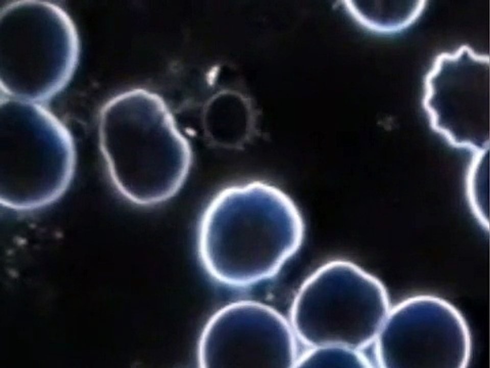 Vitalblutanalyse im Dunkelfeld nach H.P. Janus, Dozent Dr. Oettmeier, Klinik im Leben, Greiz