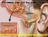 Tinnitus home remedies and natural cures Tinnitus