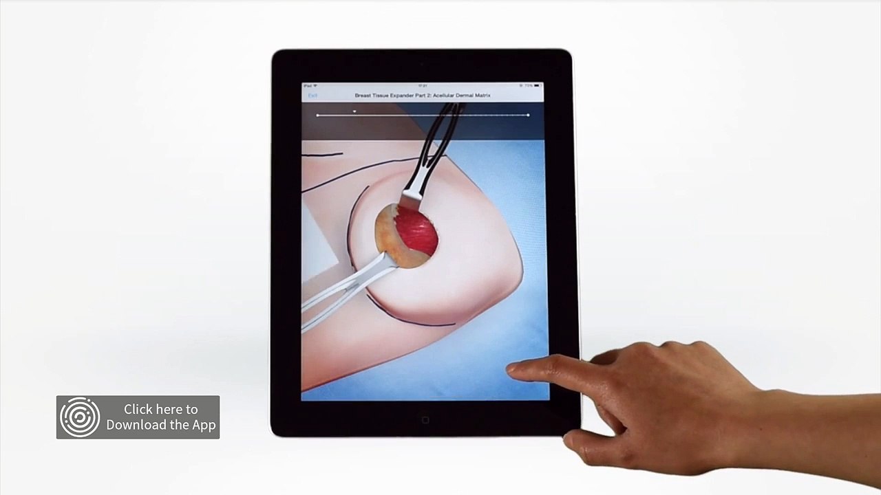 Touch Surgery Surgical Simulator