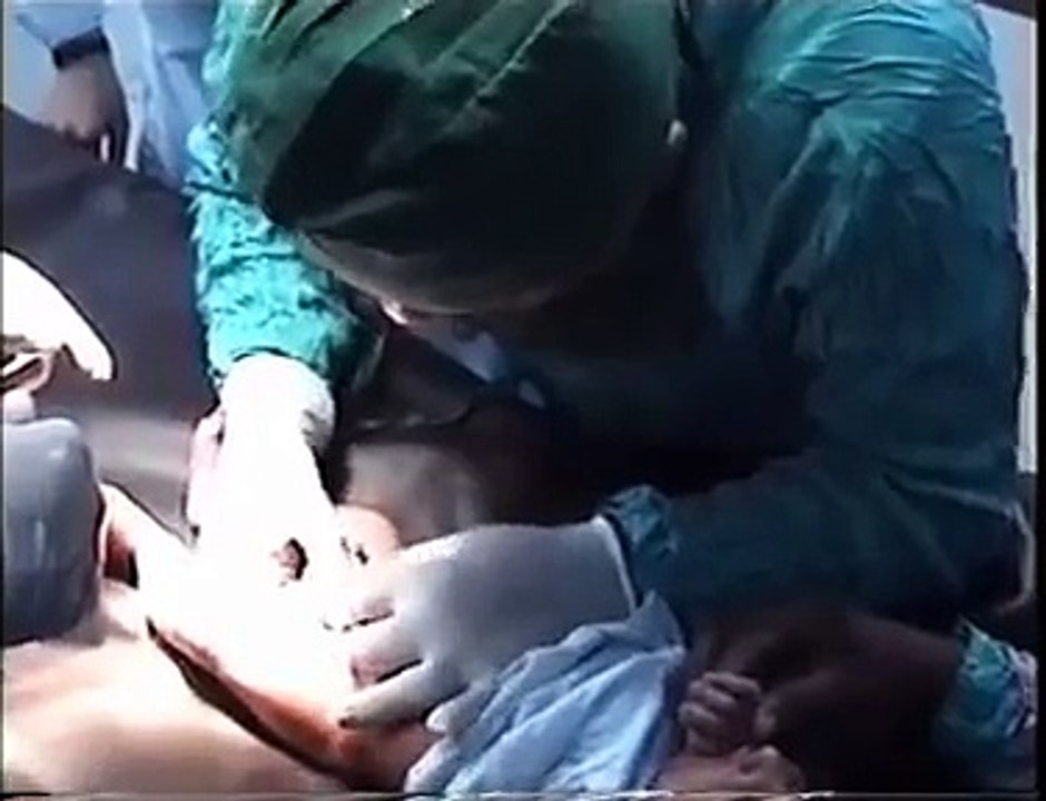 CIRCUMCISION-KHATNE- TAIBA HOSPITAL GUJRANWALA PAKISTAN.mpg
