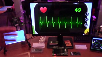 Freescale Technology Forum (FTF) 2015: Toradex - Scalable Computer on Modules
