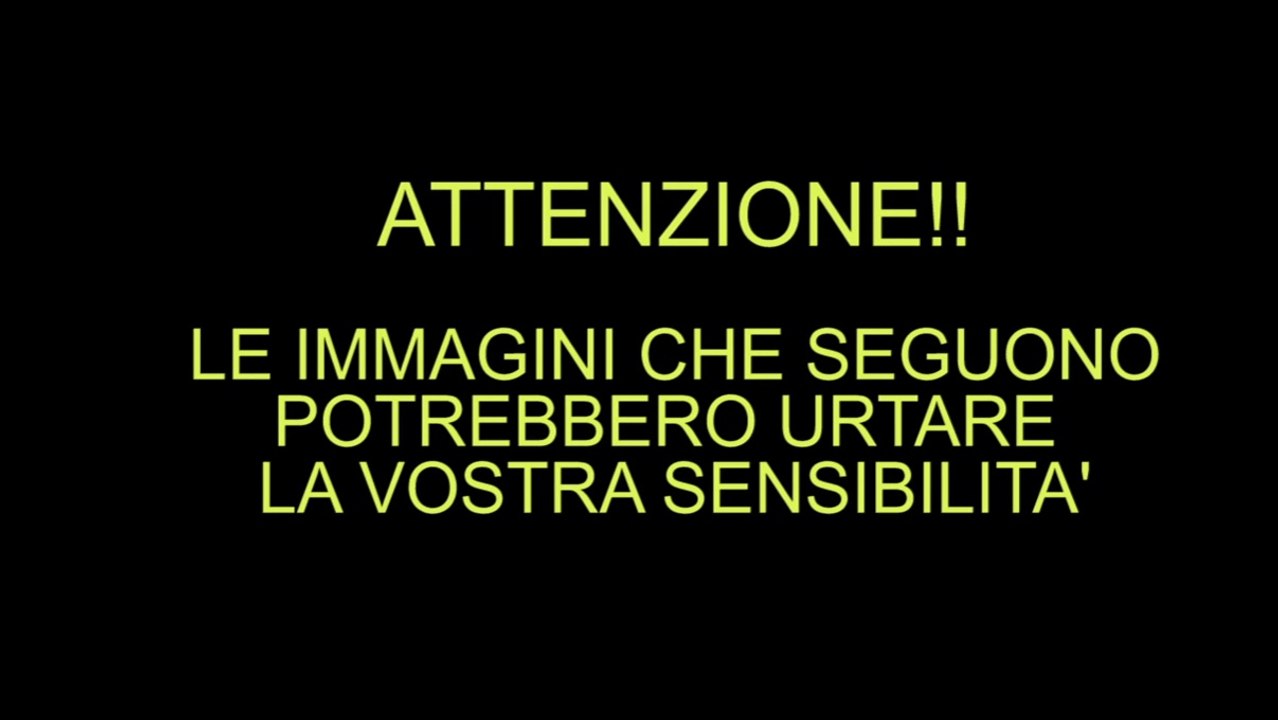 Aveva un prurito nell'orecchio, quello che scopre è raccapricciante