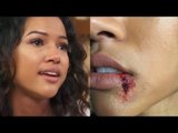 Did Chris Brown Give Karrueche Tran A Bloodied And Bruised Lip?- The Truth