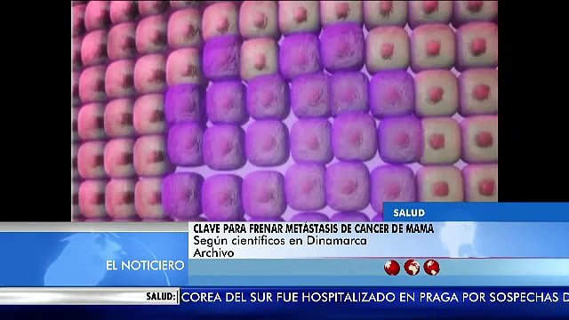 Científicos realizaron avances para prevenir la metástasis del cáncer de mama
