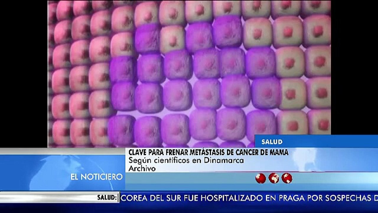 Científicos realizaron avances para prevenir la metástasis del cáncer de mama