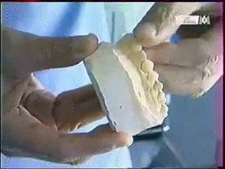 peur  dentiste  PHOBIE DENTAIRE stomatophobie clinique dentaire