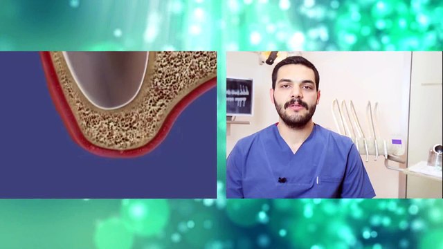 Sinüs lifting nedir? - Dt. Hakkı Serdar Ünal