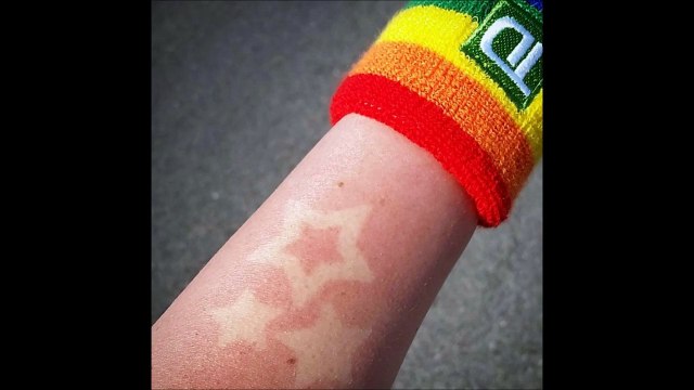 Coups de soleil artistiques - nouvelle mode à la con