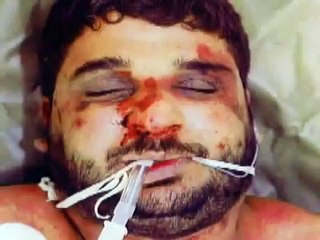 Torture (Damages) Bill: Justice for torture survivors