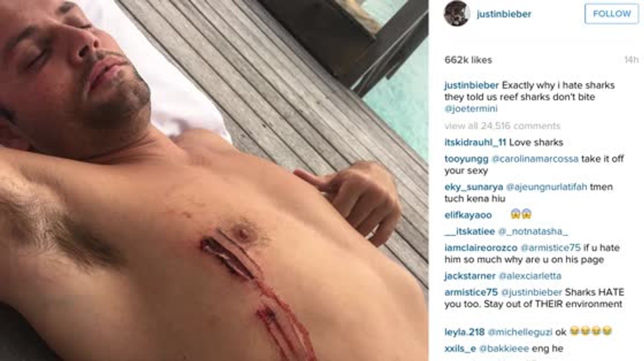 Un ami de Justin Bieber s'est fait mordre par un requin