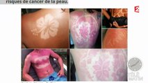 Canicule : gare aux coups de soleil !