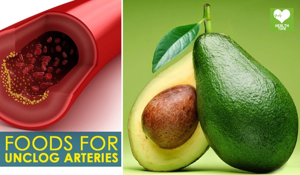 Arteries Unclog Foods | Best Health Food