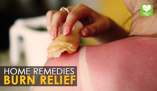 Skin Burn Treatment (स्किन बर्न) - Home Remedies | Health Tips