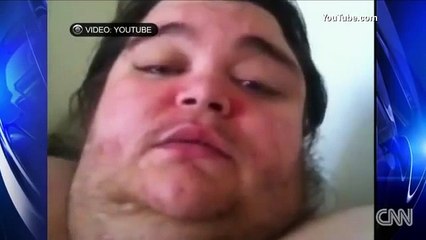700 lb 23 Year Old American : Robert Gibbs
