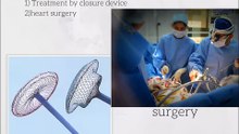 asd Repair in Kerala