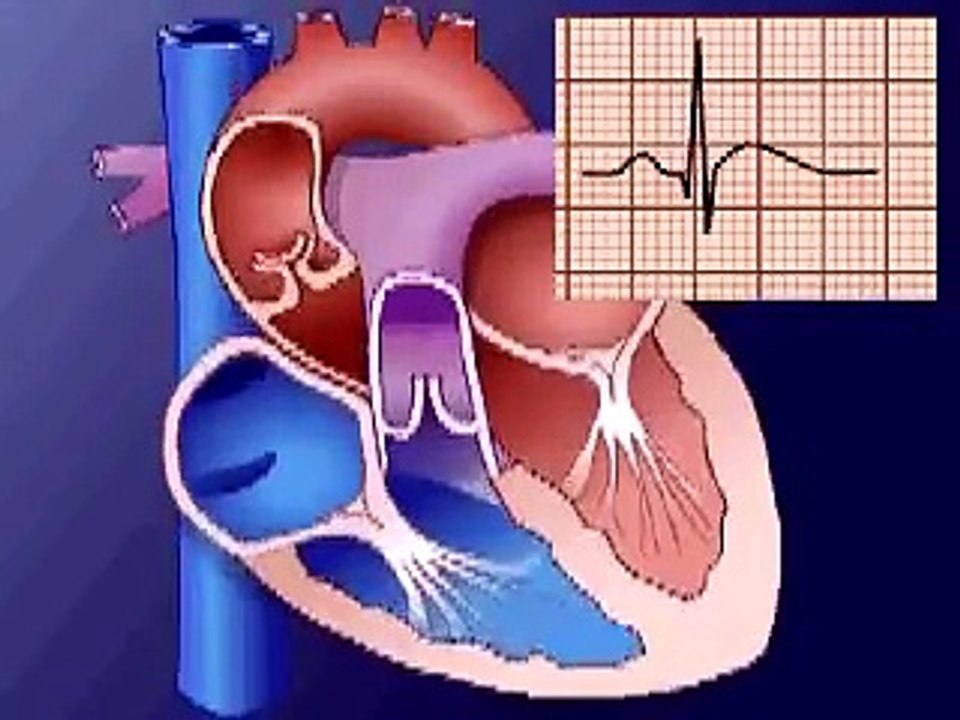 Electrocardiograma Básico
