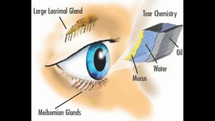 Longmont Potion Castle 11 - Teary Eyed