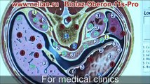 Biolaz-Oberon-11S-Pro Bioresonance medical diagnostics machine (New)