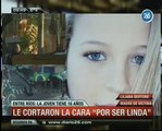 Canal 26 -Entre Ríos: cortan rostro a joven de 16 años por linda