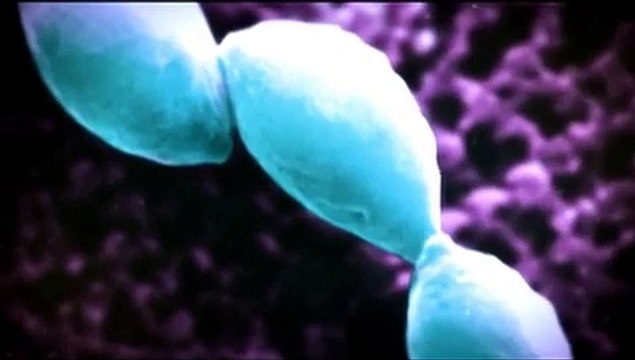 Parasitas Assassinos - Toxoplasmose