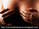 Como Eliminar El Cancer de Mama - Cancer de mama La Cura?