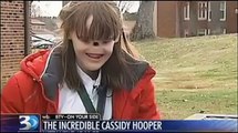 Girl Born With No Eyes and Nose Receives a Miracle