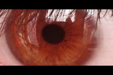 Biokinesis, cambio de color y despigmentación de iris con audios (café a verde en 7 días)