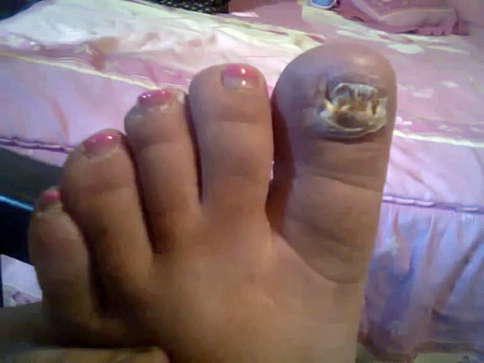 CORRIGE TU HONGO EN UÑAS DE PIES.
