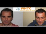 FUE Hair Restoration by Dr. Patrick Mwamba - Best hair transplant clinic in Belgium