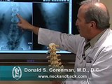 How to Read X-rays of the Lumbar Spine (Lower Back) | Spine Surgeon Colorado