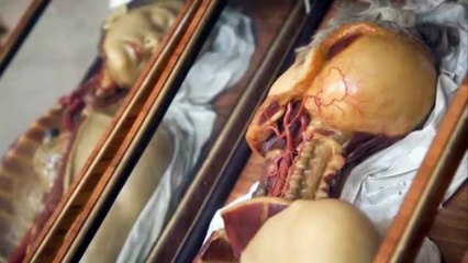 El Primer Trasplante de Cabeza, Primera vez en la Historia? (2016)