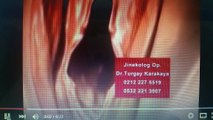 Kızlık Zarı Dikimi Fiyatı Jin Op Dr Turgay Karakaya