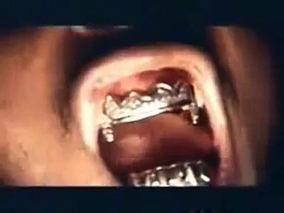 Odb- Brooklyn Zoo Video