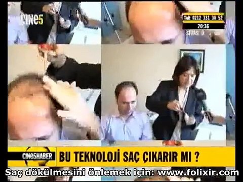 Saç Dökülmesine Kesin Çözüm: Folixir - Prof. Dr. Meral Şaşoğlu