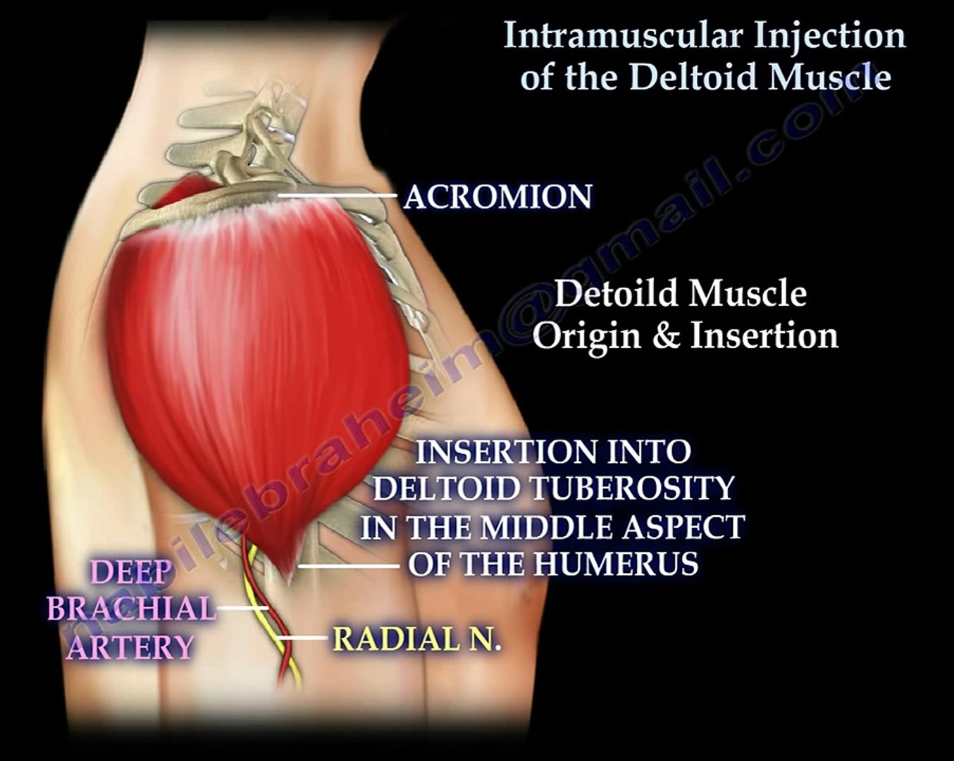 Intramuscular Injection Deltoid