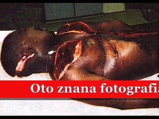 Sekcja Zwłok 2Pac'a (Dowody)